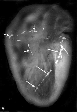 Figure 9. Post-mortem X-rays of 3 hearts before injection of barium gelatin mass (A, B, D) and the dissected coronaries of one heart not injected (C).