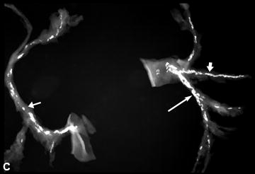 Figure 9. Post-mortem X-rays of 3 hearts before injection of barium gelatin mass (A, B, D) and the dissected coronaries of one heart not injected (C).