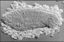 Figure 9.33. Eosinophils attacking a schistosome larva in the presence of serum from an infected patient.