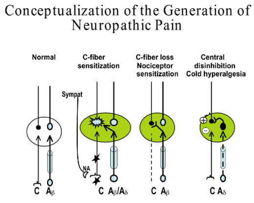 Figure 13. . Schematic representation of the generation of pain.