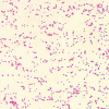 Gram stain showing brucella, a gram-negative bacteria