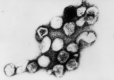 Rubella Virus, Transmission Electron Micrograph