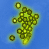 Electron Microscopic View of H1N1 Influenza Virus Particles