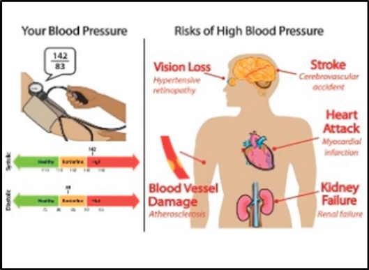 SOURCE: Arcia et al