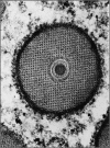 Figure 4. . Cross section of a granulovirus of Plodia interpunctella.