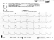 Fig. 11.2. 12-lead ECG.