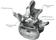 Lumbar Vertebra, Superoposterior View