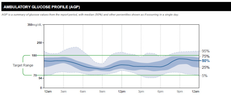 FIGURE 7: . Representative Ambulatory Glucose Profile of a patient with FCPD well controlled on basal-bolus insulin therapy (Time in range 87%; time above range 10% and time below range 3%; glucose management indicator 6.