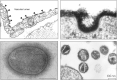 FIGURE 1.4.. (Upper left) Historical electron micrograph of endothelial cells from a blood capillary in the rat diaphragm muscle, showing the lumenal cell membrane of the cells (facing the blood) decorated with particles of cationized ferritin (arrowheads).