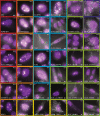 Figure 16.4. Subcellular and subnuclear localization of RNAs in punctate domains.