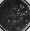 Figure 6.6. Photograph of immortalized cells created by a fusion between a myeloma cell line and spleen cells from a mouse immunized with sheep red blood cells, showing individual clones that secrete ‘monoclonal' antibodies that lyse sheep red cells, indicated by the halos.