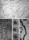 Figure 4.4. Electron micrographs taken by Donald and Ada Olins of (a) and (b, size marker 30 nm) low ionic strength chromatin spreads showing the ‘beads on a string'; (c) nucleosomes derived from nuclease-digested chromatin (size marker 10 nm); (d) chromatin spread at a moderate ionic strength showing a 30 nm higher-order structure (size marker 50 nm).