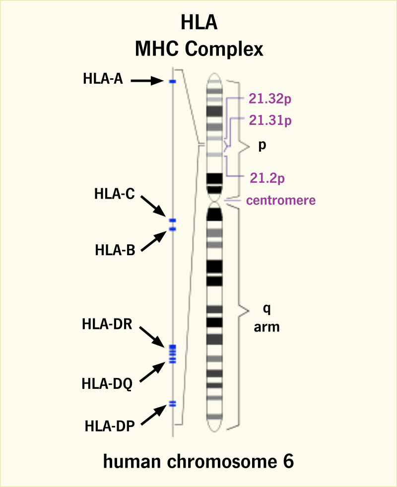 Illustration showing one chromosome, including long arm and short arm, and the locations of select class one and class two H L A genes.