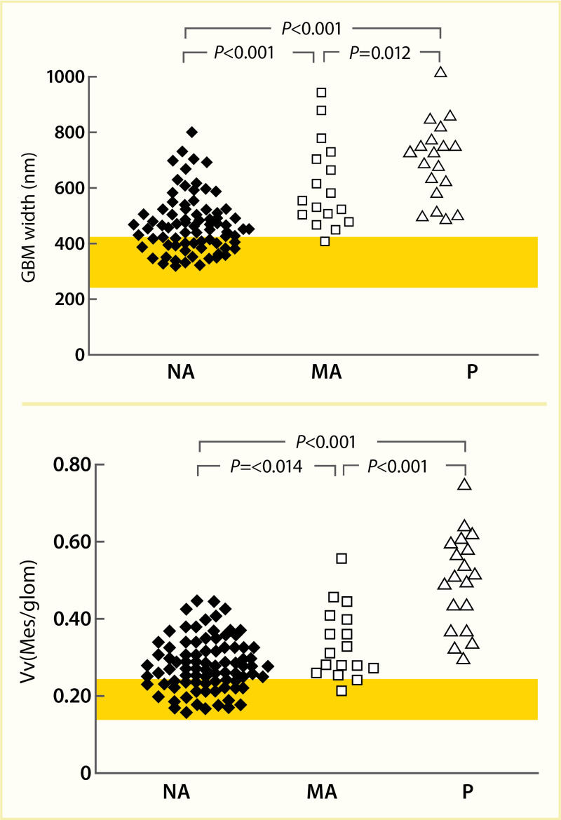 Dot plot showing glomerular basement membrane width and fractional
mesangial volume lower in normoalbuminuric persons than those with moderate
albuminuria and proteinuria