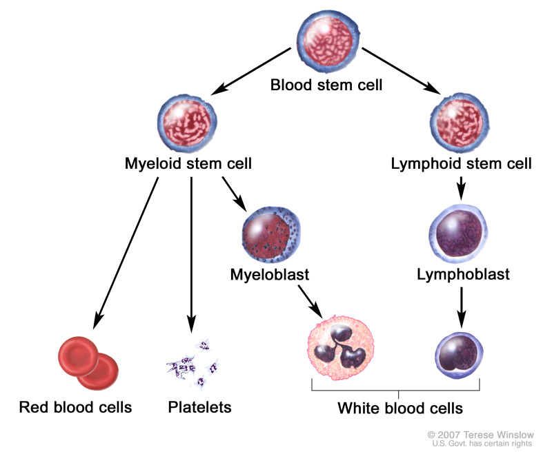 Blood cell development; drawing shows the steps a blood stem cell goes through to become a red blood cell, platelet, or white blood cell. Drawing shows a myeloid stem cell becoming a red blood cell, platelet, or myeloblast, which then becomes a white blood cell. Drawing also shows a lymphoid stem cell becoming a lymphoblast and then one of several different types of white blood cells.