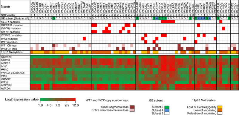 Chart showing unsupervised analysis of gene expression data for clinically distinctive favorable histology Wilms tumor.