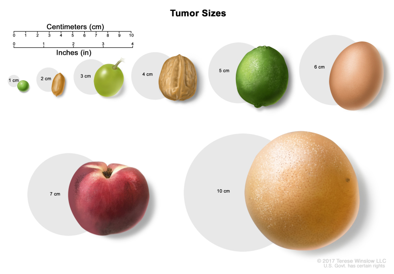 Drawing shows different sizes of a tumor in centimeters (cm) compared to the size of a pea (1 cm), a peanut (2 cm), a grape (3 cm), a walnut (4 cm), a lime (5 cm), an egg (6 cm), a peach (7 cm), and a grapefruit (10 cm). Also shown is a 10-cm ruler and a 4-inch ruler.