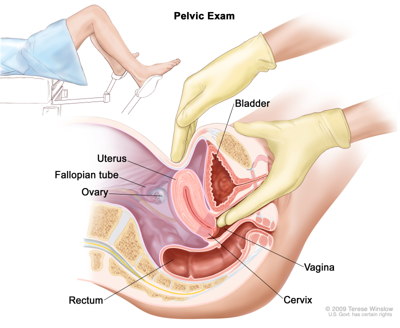 Pelvic exam; drawing shows a side view of the female reproductive anatomy during a pelvic exam. The uterus, left fallopian tube, left ovary, cervix, vagina, bladder, and rectum are shown. Two gloved fingers of one hand of the doctor or nurse are shown inserted into the vagina, while the other hand is shown pressing on the lower abdomen. The inset shows a woman covered by a drape on an exam table with her legs apart and her feet in stirrups.