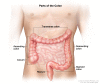 The colon includes the ascending colon, cecum, transverse colon, descending colon, sigmoid colon, and rectum