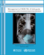 Management of MDR-TB: A Field Guide: A Companion Document to Guidelines for Programmatic Management of Drug-Resistant Tuberculosis: Integrated Management of Adolescent and Adult Illness (IMAI).